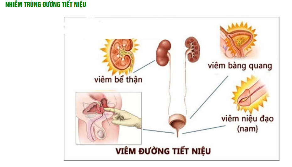 BỆNH ĐƯỜNG TIẾT LIỆU